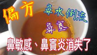 鼻敏感、鼻竇炎、鼻水倒流、鼻塞全消失 簡單偏方Nasal allergy, sinusitis, nasal reflux, nasal congestion disappeared