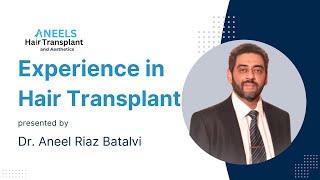 Experience in Hair Transplant | Dr. Aneel Vlog