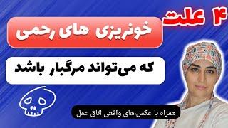 اگر خونریزی شدید پریود دارید یا بعد از،یائسگی دچار لکه بینی هستید این موضوع را جدی بگیرید