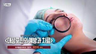 [TV메디컬약손]제761회 잠복 바이러스의 공격 '대상포진의 예방과 치료' (20241224 방송)