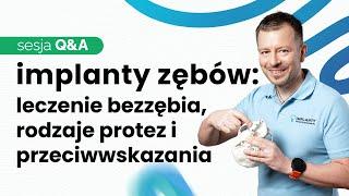 IMPLANTY ZĘBOWE - Q&A cz. IIPROTEZY NA 4 I 6 IMPLANTACH. PRZECIWWSKAZANIA DO LECZENIA