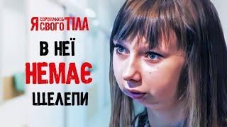 Потеряла челюсть из-за зависимости – Я соромлюсь свого тіла | ЛЕЧЕНИЕ | НАУКА | ЗДОРОВЬЕ