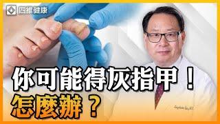 灰指甲在家就可以用的天然療法！怎樣預防和緩解症狀？