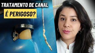 Tratamento de canal é perigoso?