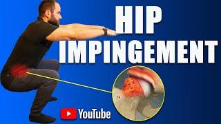 Hip Impingement Pain (FAI) Best Exercises, Rehab & Strengthening (How to Avoid Surgery)