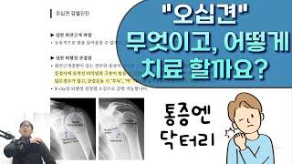 갑자기 어깨가 얼어버리는 "오십견"은 무엇이고, 어떻게 치료할까요?