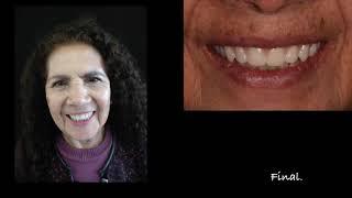 Dra. Yadelsi Sánchez-Rehabilitación_Parte II