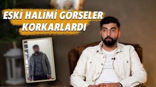 ESKİ HALİMİ GÖRSELER KORKARLARDI Yaşanmış Hayatlar B9 #bağımlılık #metamfetamin