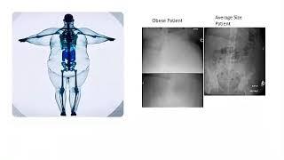 Obesity XXL X-ray Challenges