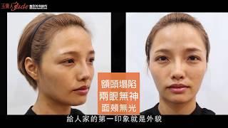 【素人案例】【素人蛻變女神見證-菲菲】翻轉倦容，化身柔美超正女業務｜全臉脂雕