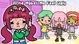 Acne Makes Me Feel Ugly   Sad Story | Toca Life World | Toca Boca