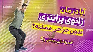 درمان زانوی پرانتزی بدون جراحی فقط با یک شرط  ممکن است! حتما ویدیو را ببینید