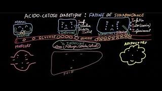 Acido-cétose diabétique - Famine de Surabondance - Partie 1 - Docteur Synapse