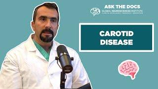 Ask the Docs  - Carotid Disease with Dr. Zak Hakma