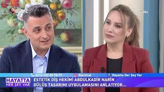 Gülüş Tasarımı Doktoru  Estetik Diş Hekimi Dr. Abdulkadir Narin - Nişantaşı Diş Hekimi