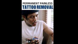 Permanent Painless Tattoo Removal || Get Rid Of Old , Ugly Tattoo's | #tattooremoval #drsandeshgupta