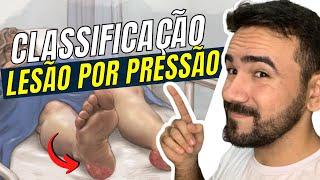 CLASSIFICAÇÃO DA LESÃO POR PRESSÃO - AULA COMPLETA