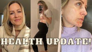 Health Update 2023! Fixing My Bloating & Adult Acne, Lara Joanna Jarvis | Gut Health & skin+me