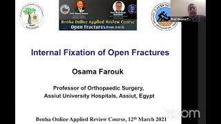 Internal Fixation of Open Fractures ( Prof. Osama Farouk )