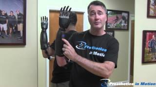 Below The Elbow Amputee Demonstrates BeBionic 3 Myoelectric Prosthesis