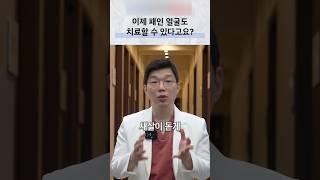 얼굴이 패여있는 것도 해결이 된다고요? #패인피부#여드름흉터#큐어젯#피부과