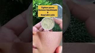 Open Pores TreatmentNaturally At Home/Remove Blackheads #shorts #skincare #ytshorts