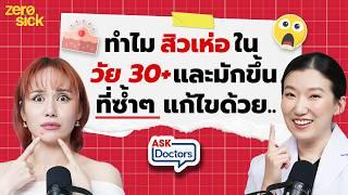 สิวเห่อเพราะ PM 2.5 สิวหายช้า ขึ้นที่เดิมซ้ำๆ หลัง 30+ ทิ้งรอยแดงรอยดำ แก้ไขด้วย…I Ask Doctor’s EP10