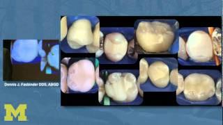 Digital Technology for Restorative Dentistry