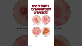 Drug of choice for infection // Antibiotics // pharmacology #medical #antibiotics #health #drugs