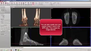 CubeVue - Insta-X X-Ray Views