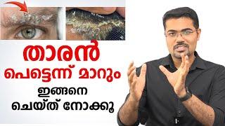 താരൻ പെട്ടെന്ന് മാറും ഇങ്ങനെ ചെയ്താൽ | Dandruff Treatment at Home |Dr Manoj Johnson /Baiju's Vlogs