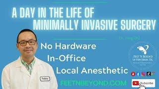 Minimally INvasive Vlog w/ Dr. Zhu