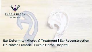 Ear Deformity (Microtia) Treatment | Ear Reconstruction | Dr. Nitesh Lamoria | Purple Heron Hospital