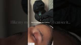 BioRePeel: The Ultimate Skin Rejuvenation Treatment!