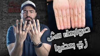 ليه صوابعك مش زي بعضها؟