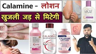 खुजली का इलाज | Calamine Lotion | Antifungal Cream | Treatment | Medicine | Pharmacy | Infection