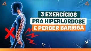 3 exercicios para melhorar da HIPERLORDOSE e perder a barriga - Fisioprev