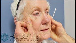 FACELIFT SURGERY- Award Winning " Best of Nashville" Plastic Surgeon Dr. Chad Robbins