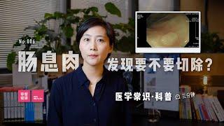 「医学常识」发现大肠息肉，要不要马上切除？