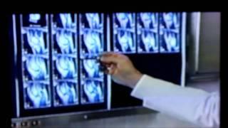 Open MRI Kendrick hospital