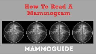 How To Read A Mammogram