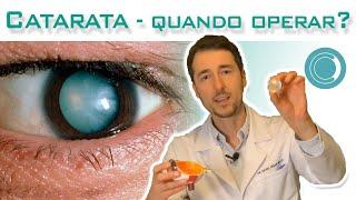 Catarata - quando operar?