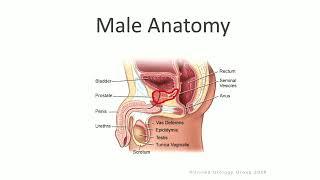 Robot Assisted Radical Prostatectomy