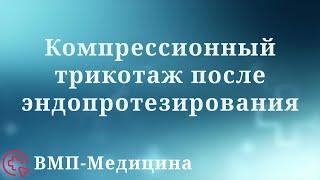 Компрессионные чулки и бинты после эндопротезирования | ВМП-Медицина