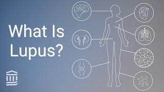 Understanding Lupus: Causes, Symptoms, Treatment, and Flare Ups | Mass General Brigham