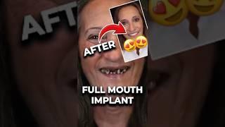 This Smile Makeover Will Blow Your Mind! 