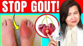 Do These 3 Things To Ease Gout at Home!