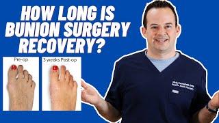 HOW LONG DOES BUNION SURGERY RECOVERY TAKE?