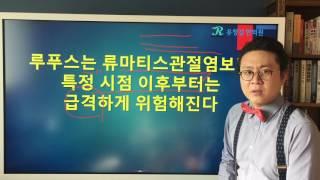 루푸스(Lupus) 질환의 특징[1] : 갑작스럽게 급격히 악화되는 루푸스