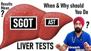 High SGOT AST Test Results Meaning | Explained by Dr.Education